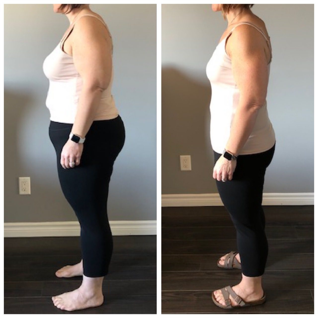Weight Loss Before and After - Mandy