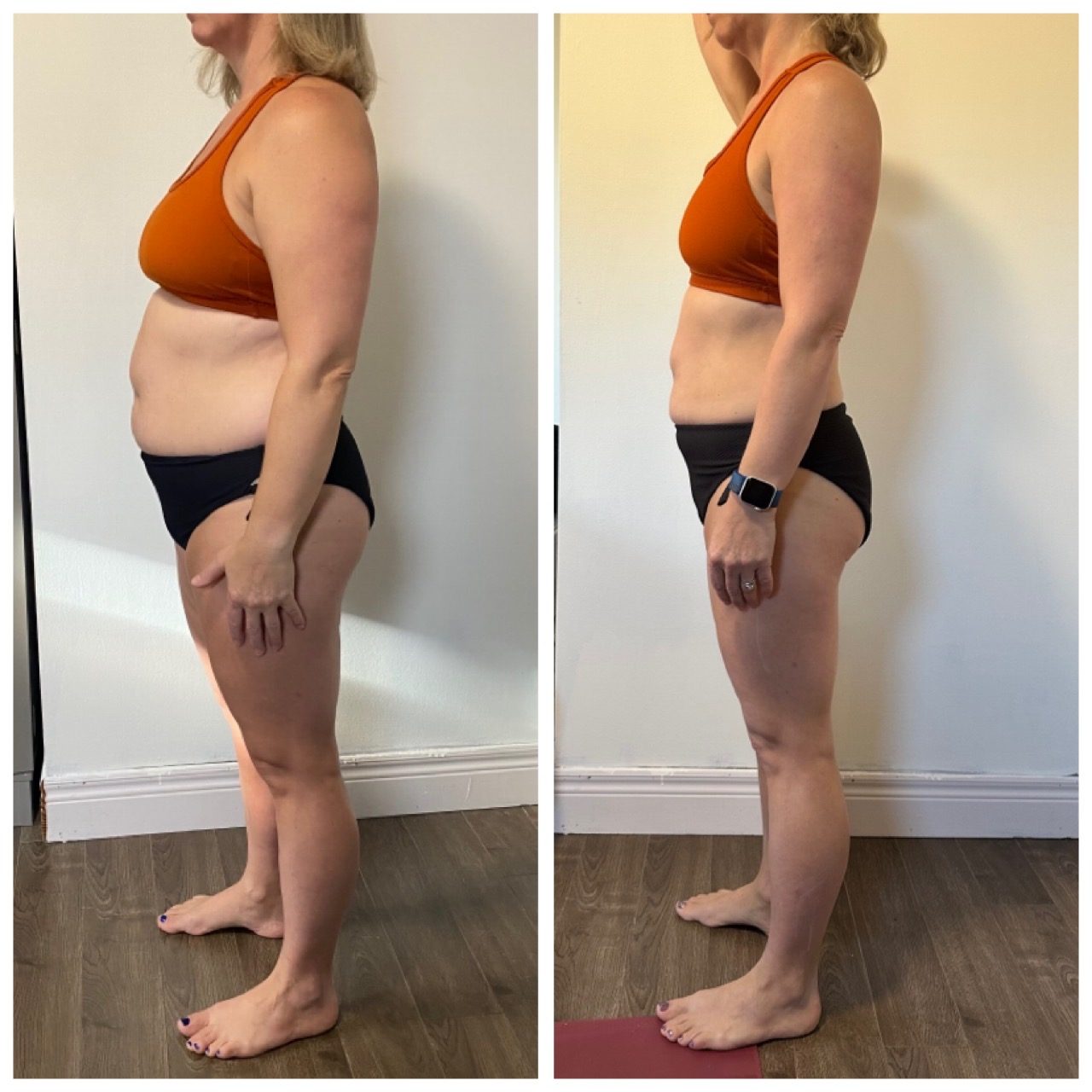 Weight Loss Before and After - Tina